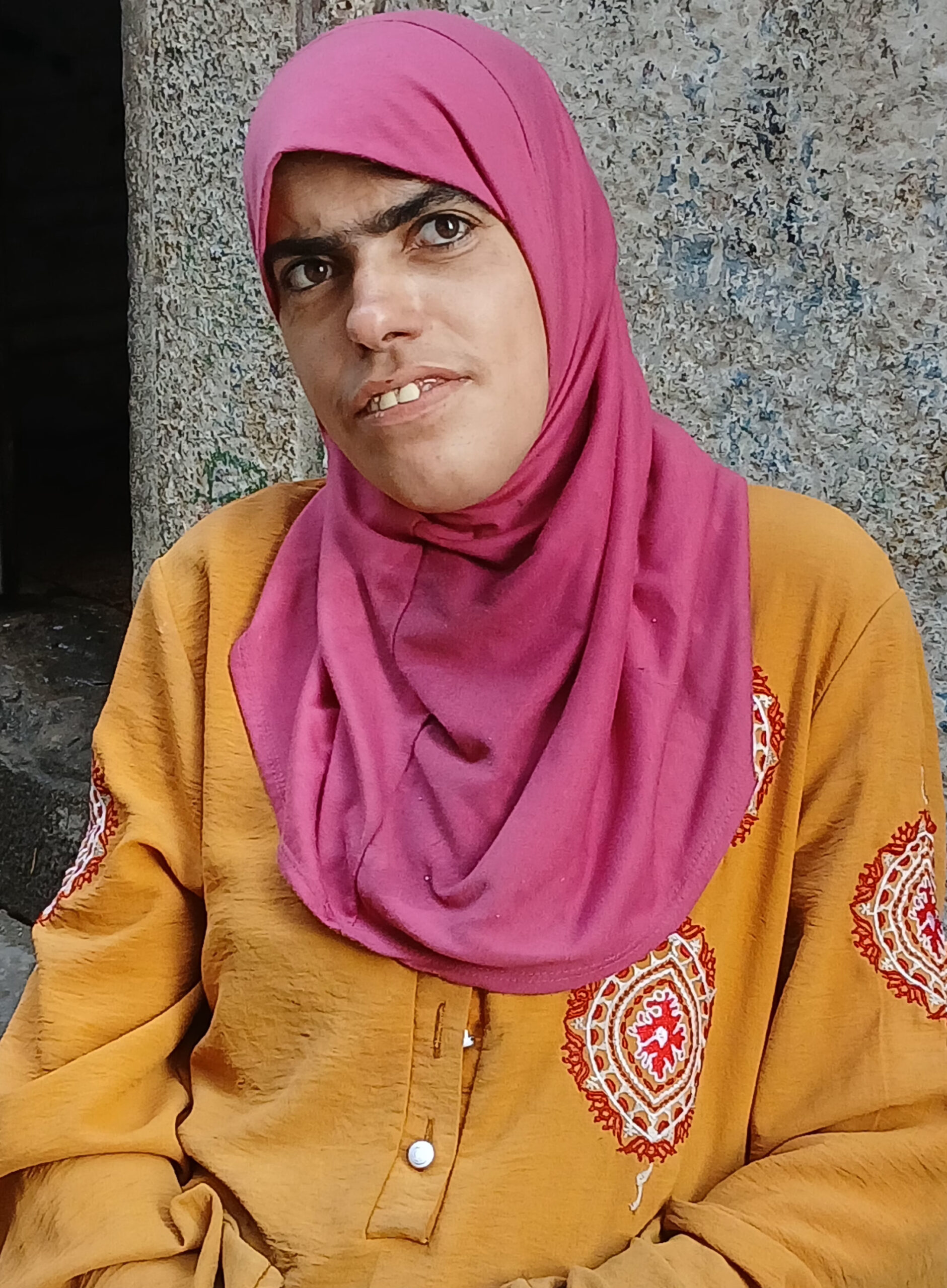 ياسمين بعدما فقدت الكثير من وزنها وتدهورت صحتها خلال الحرب. 
